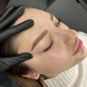 Техника ХНА