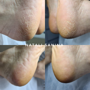 Наталия Санина, Киев Фото - 74