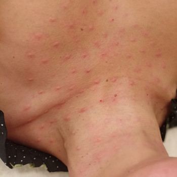 Светлана Гондарь, Днепр Фото - 7