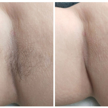 Марина Осіпова, Чернівці Фото - 11