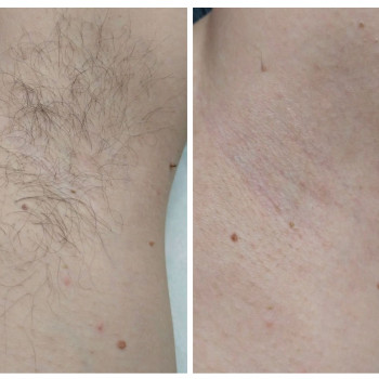 Марина Осіпова, Чернівці Фото - 12