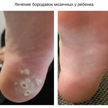 Руслана Петровна Гончарова, Одесса Фото - 20