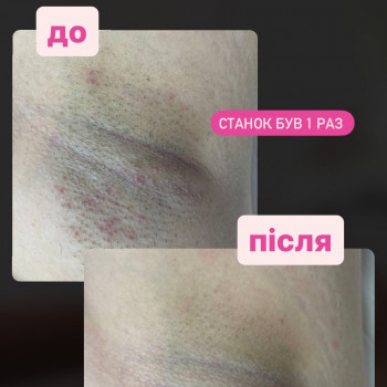 Фото из портфолио мастера Анастасія Ільчук (мастер депиляции, Киев)