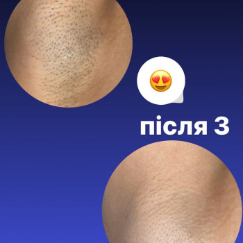 Фото из портфолио мастера Анастасія Ільчук (мастер депиляции, Киев)