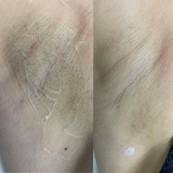 Фото из портфолио мастера Анастасія Ільчук (мастер депиляции, Киев)