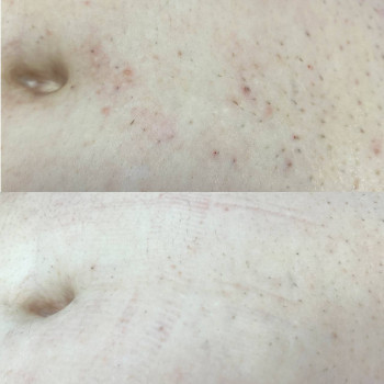 Фото из портфолио мастера Анастасія Ільчук (мастер депиляции, Киев)