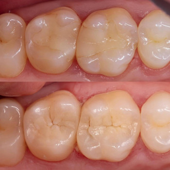 Владислав Ковальчук, Черновцы Фото - 1