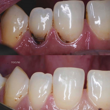 Владислав Ковальчук, Черновцы Фото - 3