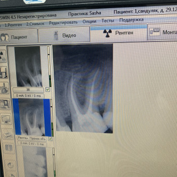 Владислав Ковальчук, Черновцы Фото - 4