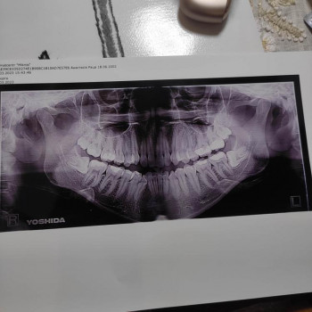 Владислав Ковальчук, Черновцы Фото - 5