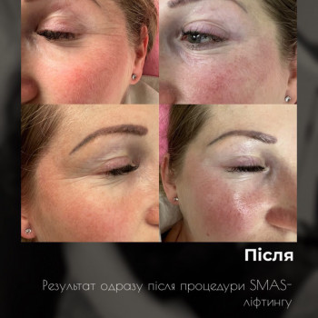 Тетяна Юрко, Винница Фото - 9