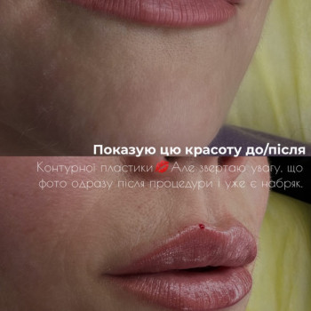 Тетяна Юрко, Винница Фото - 14