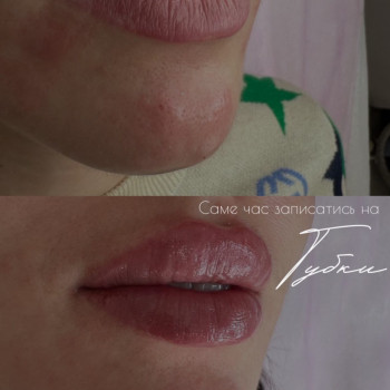 Тетяна Юрко, Винница Фото - 15