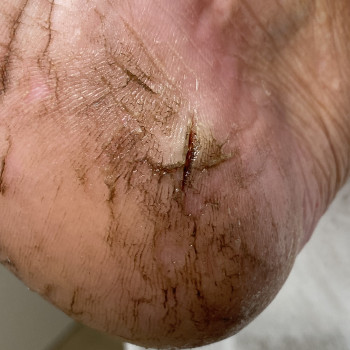 Наталія Грабар, Шпола Фото - 6