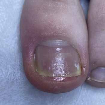 Наталія Грабар, Шпола Фото - 7