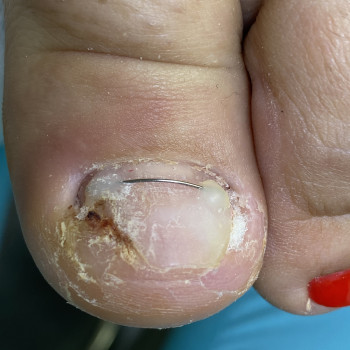 Наталія Грабар, Шпола Фото - 9