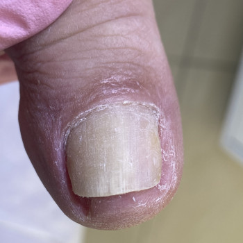 Наталія Грабар, Шпола Фото - 15