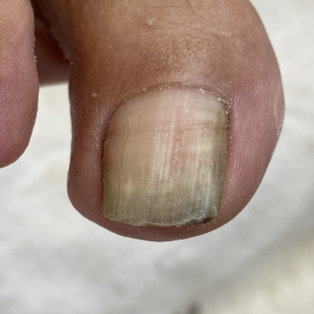 Наталія Грабар, Шпола Фото - 16