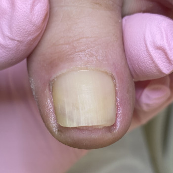 Наталія Грабар, Шпола Фото - 17