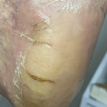 Наталія Грабар, Шпола Фото - 19