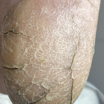 Наталія Грабар, Шпола Фото - 21