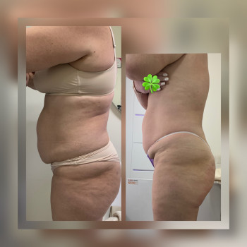 Мультімаскінг
                    Косметолог-эстетист Зинаида Ужгород