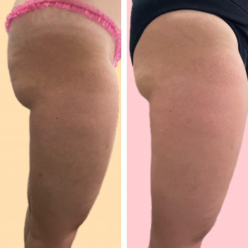 Мультімаскінг
                    Косметолог-эстетист Зинаида Ужгород