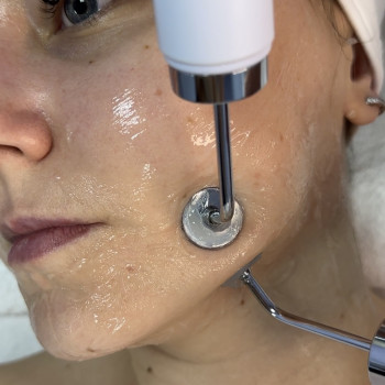 Мікроструми