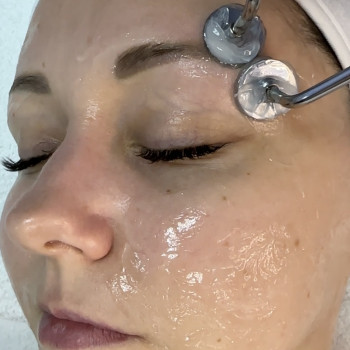 Мікроструми