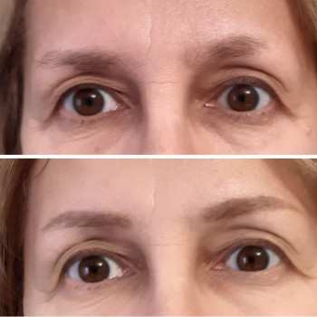 Татуаж брів.До та через 1 місяць