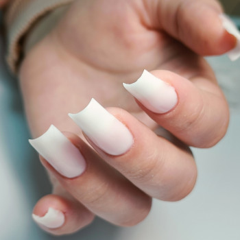 Аліна Плескань, Вінниця Фото - 11