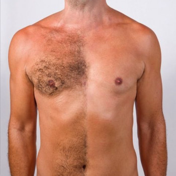 Груди
Шугаринг Чоловічий