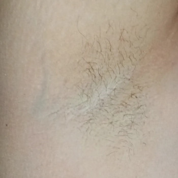 Воскова депіляція
                    Косметолог-естетист Інна Кривий Ріг