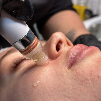 Аквапілінг