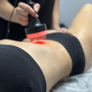 Біостимуляція мязів