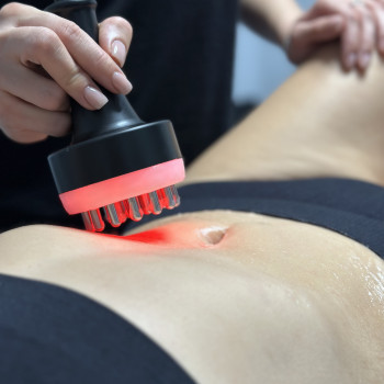 Біостимуляція мʼязів