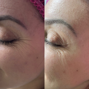 Руслана Мицней, Черновцы Фото - 42