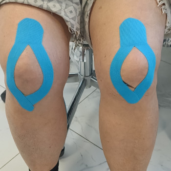 Тейпування квадратного м'язу поясниці
                    Масажист Виктория Київ