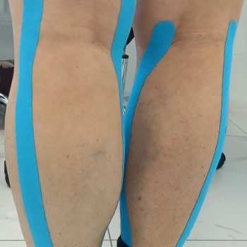 Тейпування квадратного м'язу поясниці
                    Масажист Виктория Київ