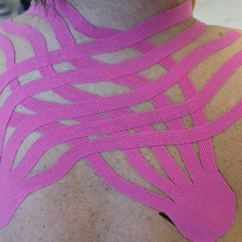 Тейпування квадратного м'язу поясниці
                    Масажист Виктория Київ