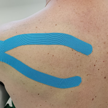 Тейпування квадратного м'язу поясниці
                    Масажист Виктория Київ