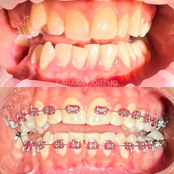 Жанна Мельник Каракай, Винница Фото - 6