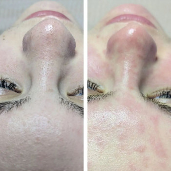 Flower lady, Черкаси Фото - 9