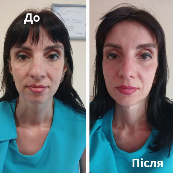 Flower lady, Черкаси Фото - 10