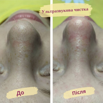 Flower lady, Черкаси Фото - 22