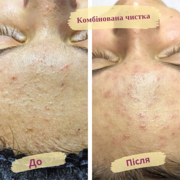 Flower lady, Черкаси Фото - 23