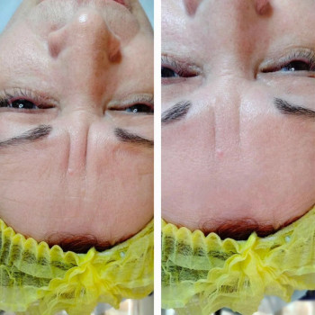 Flower lady, Черкаси Фото - 26