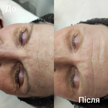 Flower lady, Черкаси Фото - 30