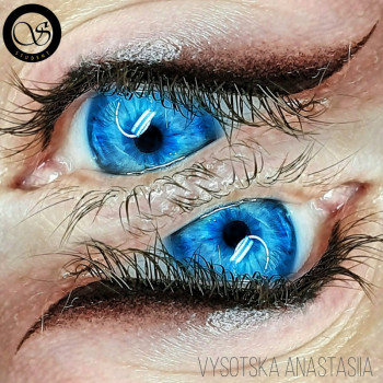 Фото из портфолио косметолога Анастасия Высоцкая (Борисполь)