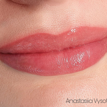 Фото из портфолио косметолога Анастасия Высоцкая (Борисполь)